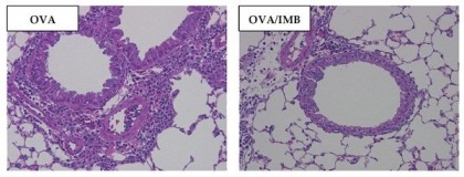 Boabele de soia fermentate suprimă inflamația căilor respiratorii indusă de astm