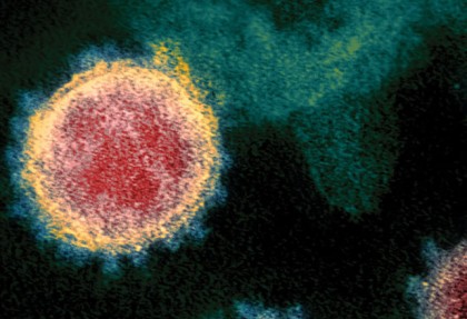 Infecția simultană cu virusul SARS-CoV-2 și un rinovirus uman, asociată cu rezultate mai severe asupra sănătății
