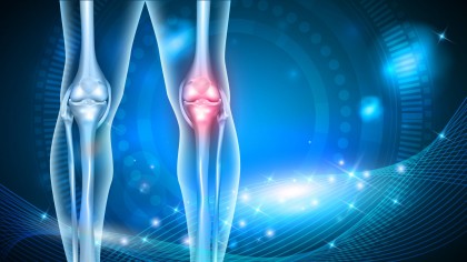 Un gel macromolecular ar putea opri sau încetini progresul osteoartritei post-traumatică