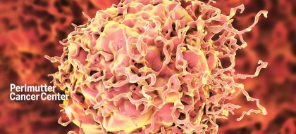 Instrumentul care ar putea ajuta la depistarea adulților cu cea mai mare probabilitate de a dezvolta cancer colorectal