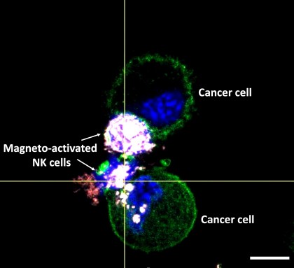 Celulele natural killer activate în câmp magnetic - posibilă terapie în tumorile solide