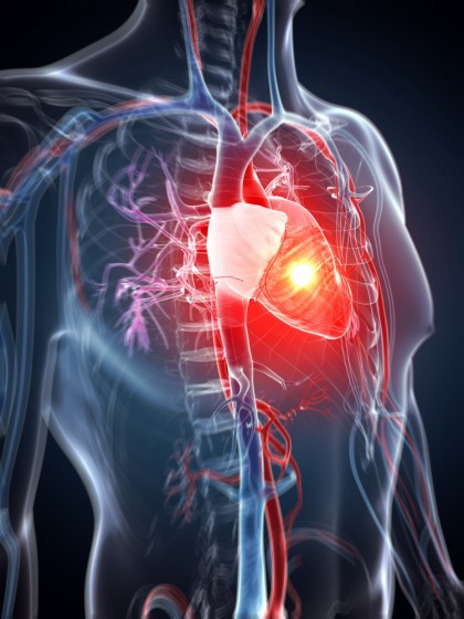 Inteligența artificială prezice dacă și când o persoană va avea stop cardiac