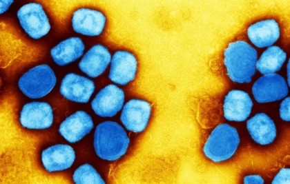 Oamenii de știință estimează perioada de incubație a variolei maimuțelor din 2022