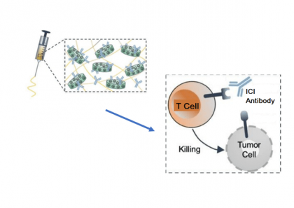 Distrugerea celulelor tumorale: imunoterapia țintită prin substanțe injectabile