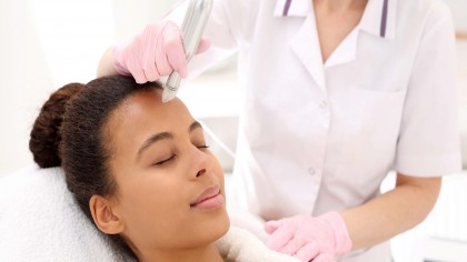 Microneedling-ul este mai eficient decât peelingul chimic pentru tratarea cicatricilor oamenilor cu piele închisă