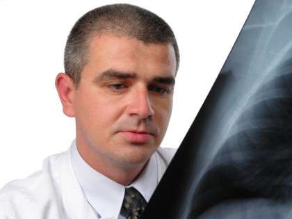 Relația dintre cancerul pulmonar și indicele de masă corporală, influențat de rasă