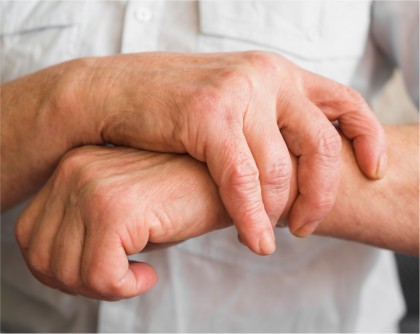 Efectele pe termen lung ale tratamentului modern pentru artrita reumatoidă: care sunt riscurile pentru pacienții cu artrită reumatoidă seropozitivă?