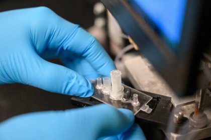 Test de sânge rapid și accesibil pentru depistarea cancerului cerebral