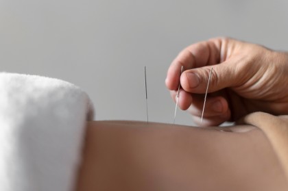 Acupunctura reduce dizabilitatea asociată durerilor lombare cronice la vârstnici