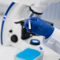 Creșterea nivelurilor circulante de L-kynurenină favorizează fragilitatea la șoarecii vârstnici