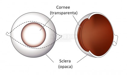 Distrofii ale stromei corneene