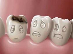 10 semne pentru problemele dentare