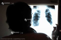 BioNTech şi Regeneron avansează în dezvoltarea unui medicament pentru cancerul pulmonar