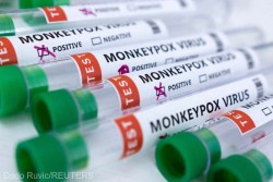 Variola maimuţei: Peste 5.000 de cazuri confirmate (OMS)