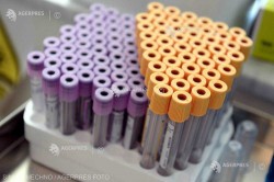 Un studiu britanic atribuie unei origini virale cazurile de hepatită neobişnuită la copii şi infirmă o legătură cu COVID-19