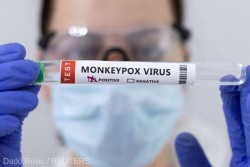 Ungaria a confirmat 42 de cazuri de variola maimuţei