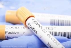 Coronavirus: Un pacient din opt prezintă cel puţin un simptom de COVID-19 lung (studiu)