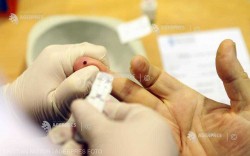 Peste 2.700 de pacienţi depistaţi cu hepatita B sau C, printr-un program de testare pentru hepatitele virale