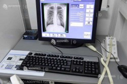 INSP: Diagnosticată şi tratată la timp, tuberculoza poate fi vindecată