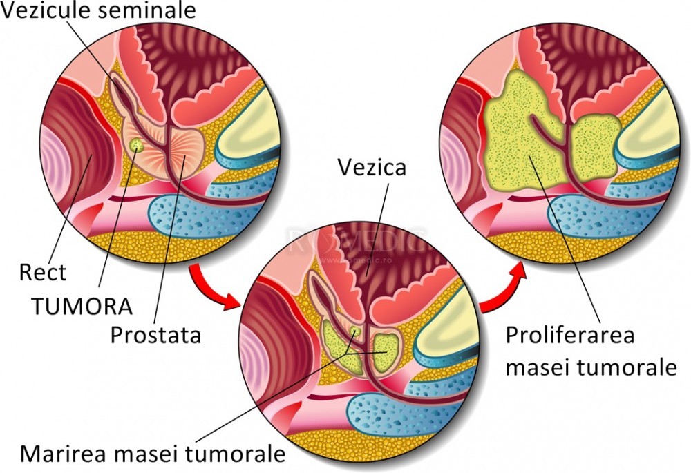 prostata functii