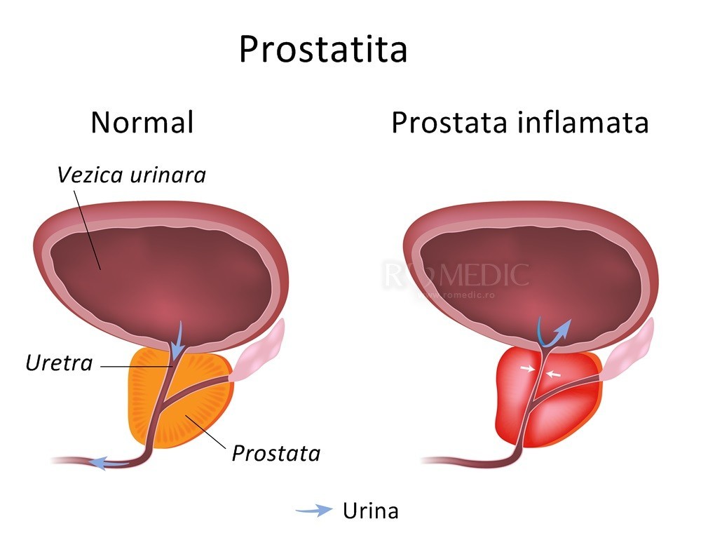 anatomia prostatei a prostatei