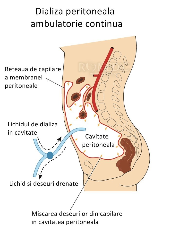 tratamentul sacului iliac)