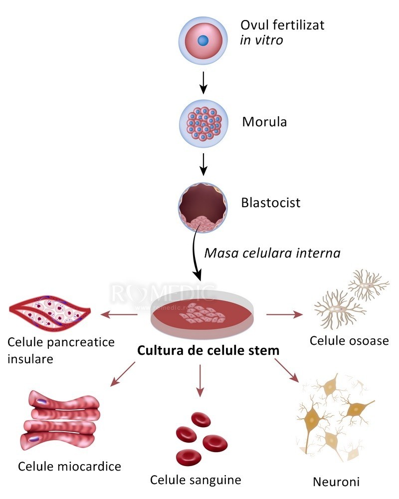 celule stem de prostatită)