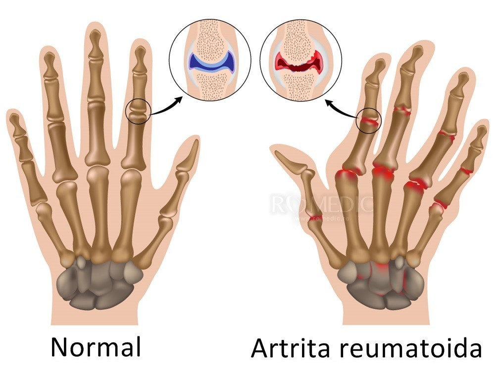 Anatomia mainii