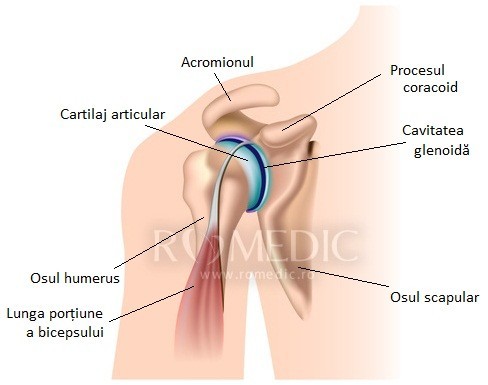 artrita articulara a umarului stang)