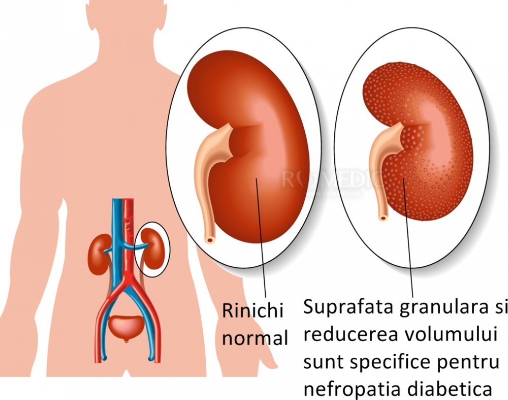 dimensiune prostata normala