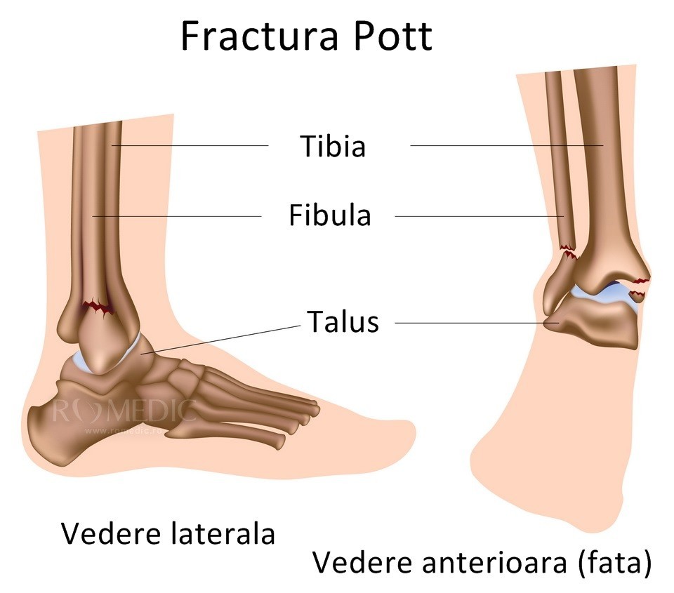 piciorul drept în articulație doare și)