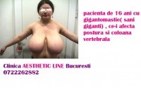 CHIRURGIE ESTETICA- EFECTELE HIPERTROFIEI MAMARE!