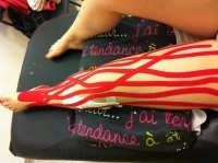 Taping-ul neuromuscular