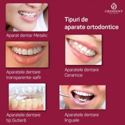 Tipuri de aparate ortodontice