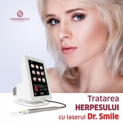 Laserul Dr. Smile