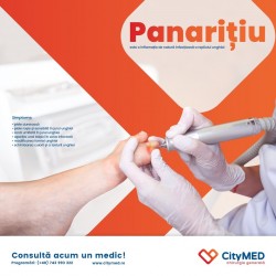 Panaritiu