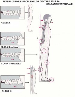 POSTUROLOGIE- ANALIZA POSTUROTEST- REPROGRAMAREA POSTURALA