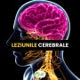 Care sunt semnele leziunilor cerebrale?