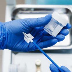 Totul despre testul Babeș-Papanicolau