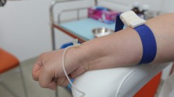 HEMOPERFUZIA: DETOXIFIEREA DE TOXINE, METALE GRELE SI VIRUSI