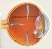 RETINOFOTOGRAF 3D OCT ( FUNDUS CAMERA)  - aparatul ideal pentru fotografia color a fundului de ochi (retina, nerv optic) 