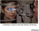 LASER ZEISS VISULAS  YAG III -	Cel mai nou si performant Laser fotodisruptor Carl  Zeiss Meditec - pentru tratamentul cataractei secundare, glaucomului, etc.
