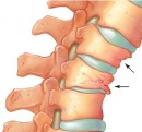 Tasare vertebrala