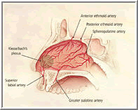 Sangerare nazala - septul nazal