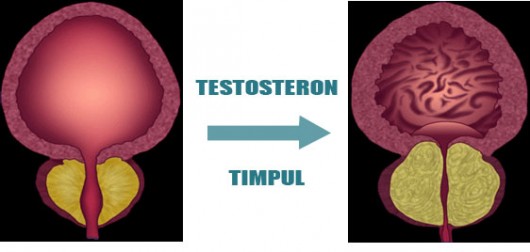 Prostata marita sau adenomul de prostata