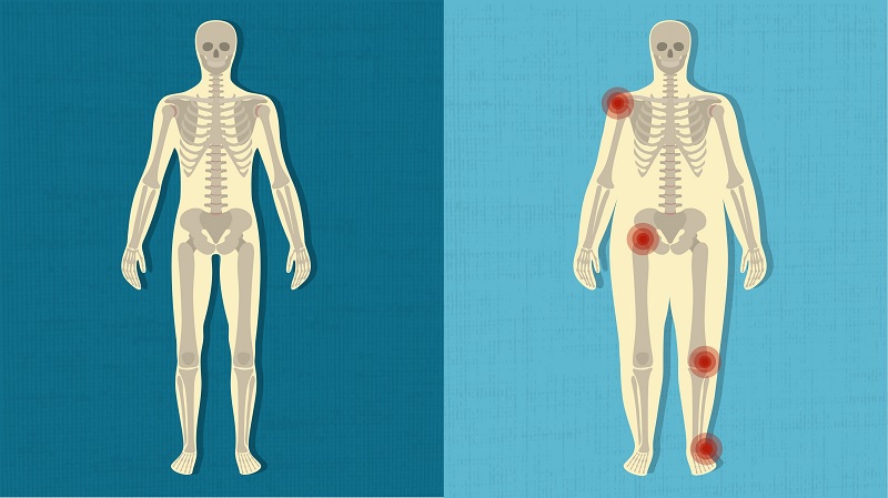 Medicamente de elasticitate articulară