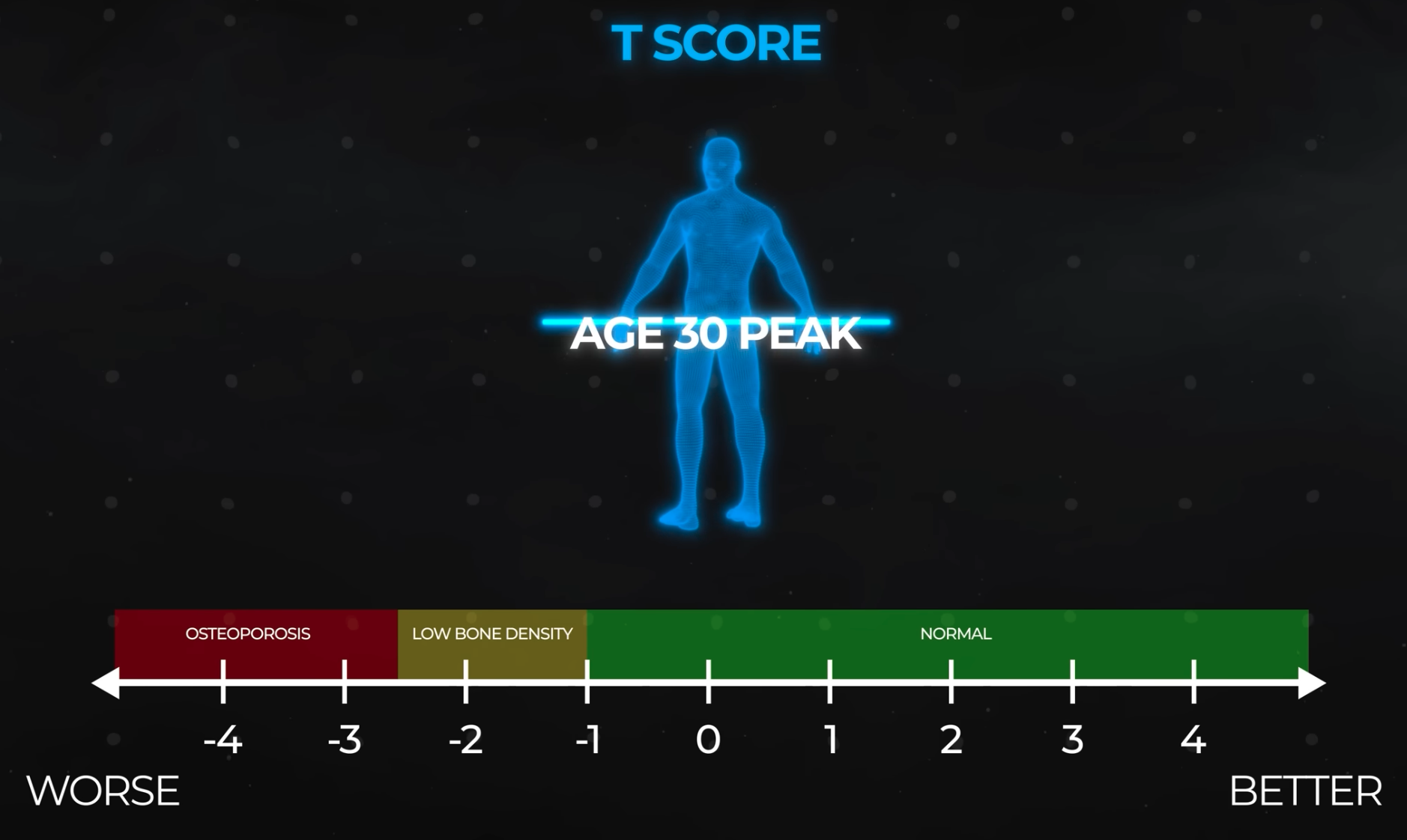 Densitatea osoasă - scorul T