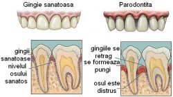 gingie_sanatoasa_bolnava