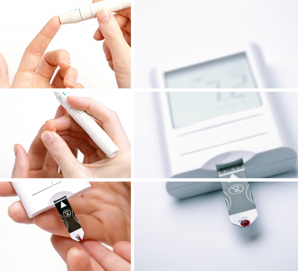 Neuropatia diabetica