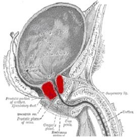 totul despre adenomul de prostata